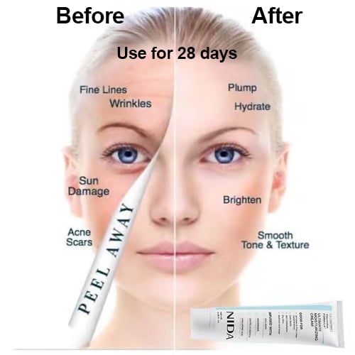 🥳VENTE EXCEPTIONNELLE 2026🥳💞Plus de 50 000 unités vendues !🌿💧 50 % de réduction ! Formule Jeunesse NIDA – La Centella Asiatica apaise, le Bifida renforce. Atténue les rides, redonne de l’éclat. 🔥💝