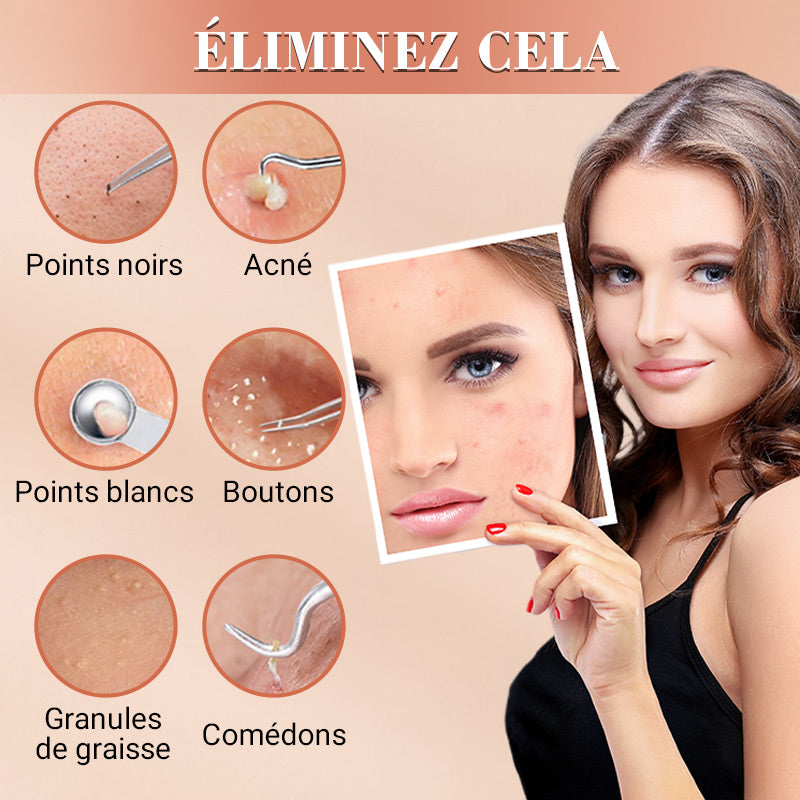💓50% DE RÉDUCTION💥Kit d'Outils pour l'Extraction de Points Noirs et Boutons📢📢3 dernières heures : Grande vente⏰⏰