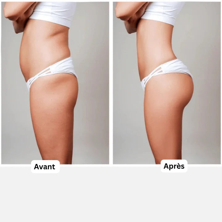 GluteUp™ Ultra-Firming Buttock Enhancer Oil