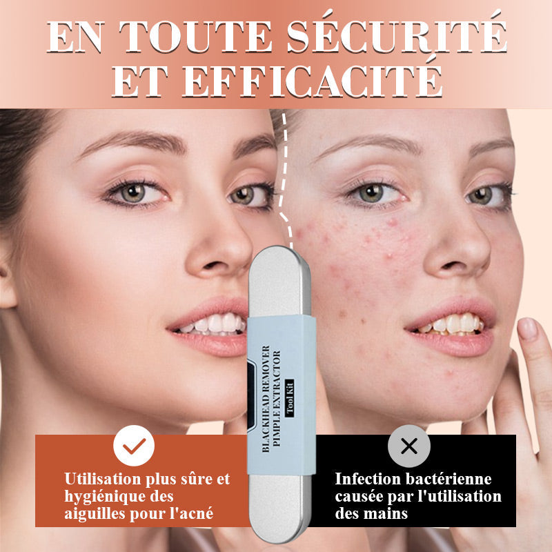💓50% DE RÉDUCTION💥Kit d'Outils pour l'Extraction de Points Noirs et Boutons📢📢3 dernières heures : Grande vente⏰⏰