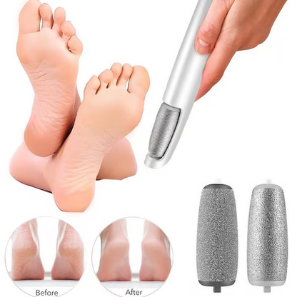 🔥 VENTE FLASH -50% ! ✨ Ponceuse Électrique pour Pieds – Peau Douce et Sain