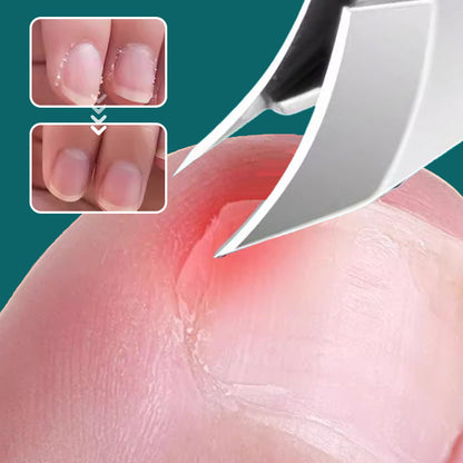 🔥2025 Vente à chaud🔥 Set de 3 pièces de coupe-ongles à bord incliné 25° anti-éclaboussures