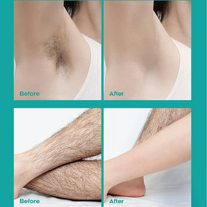 🔥Crème épilatoire indolore pour tout le corps, hommes et femmes – Douce pour toutes les zones🌿