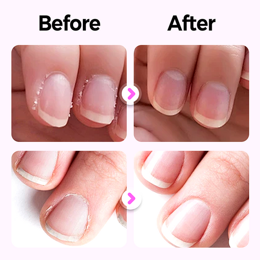 Sérum fortifiant pour les ongles en stylo Formule nourrissante, prévient les cassures, nourrit le lit de l'ongle