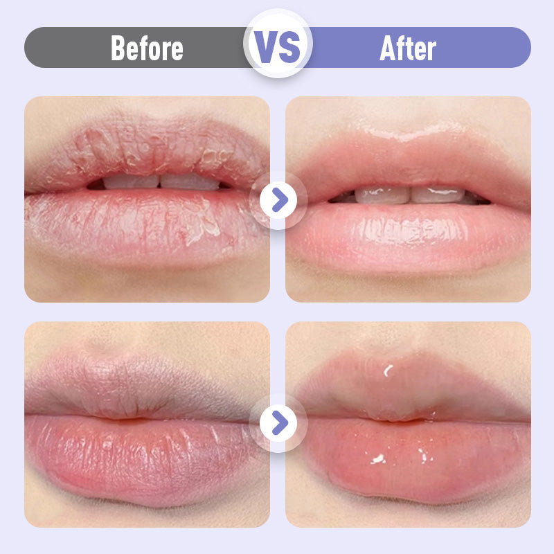 👑Sérum Hydratant Repulpant et Anti-Rides pour les Lèvres💋✨