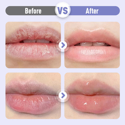 ⏳Spécial à durée limitée⏰Sérum Hydratant Repulpant et Anti-Rides pour les Lèvres💋Oferta por tempo limitado: compre um e ganhe outro grátis