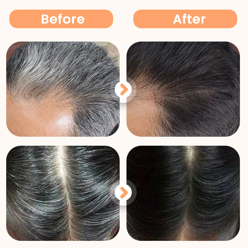 💆‍♀️🌿 Teinture Capillaire aux Extraits Végétaux pour Cheveux Blancs