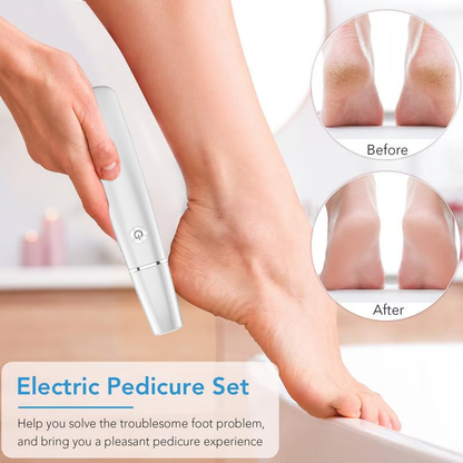 🔥VENTE LIMITÉE 50 % DE RÉDUCTION🔥Extracteur de callosités électrique pour les pieds