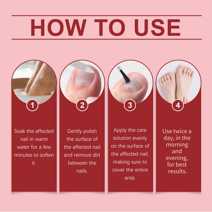 🔥Offre spéciale Noël à durée limitée : 50 % DE RÉDUCTION !!!🔥🎁Essence réparatrice pour ongles abîmés