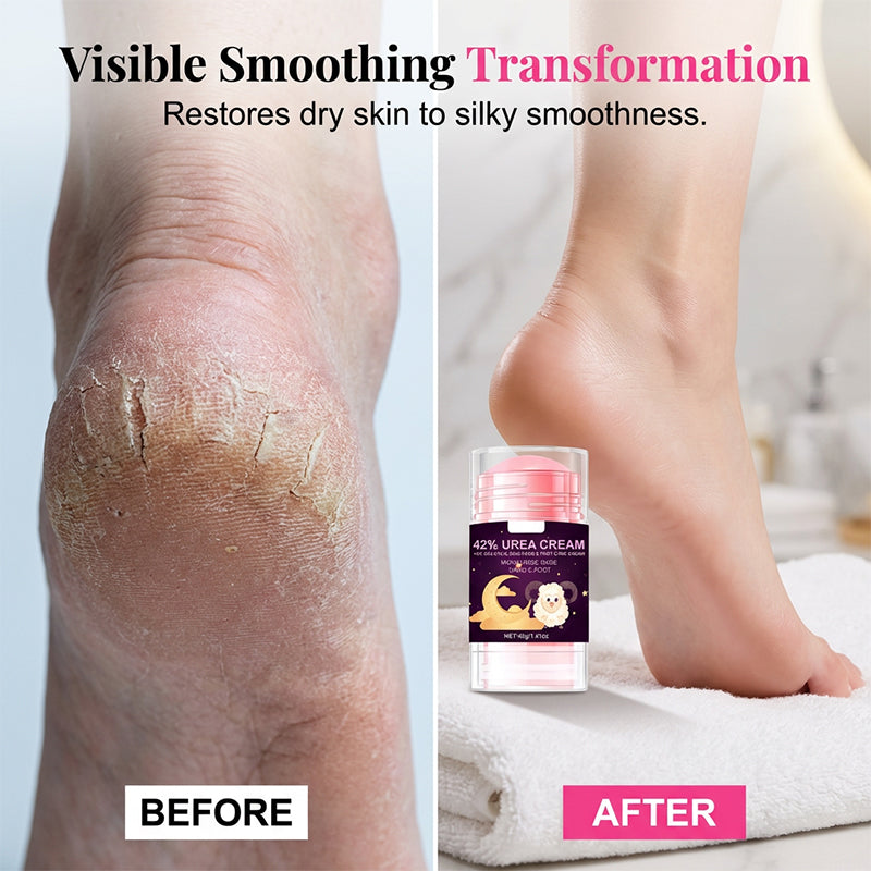 Crème réparatrice pour talons à l’acide salicylique