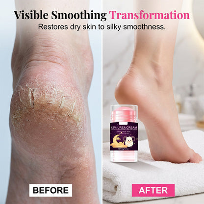 Crème réparatrice pour talons à l’acide salicylique